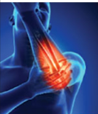Homoeopathic treatment for arthritis and joint pain in Manchar Pune